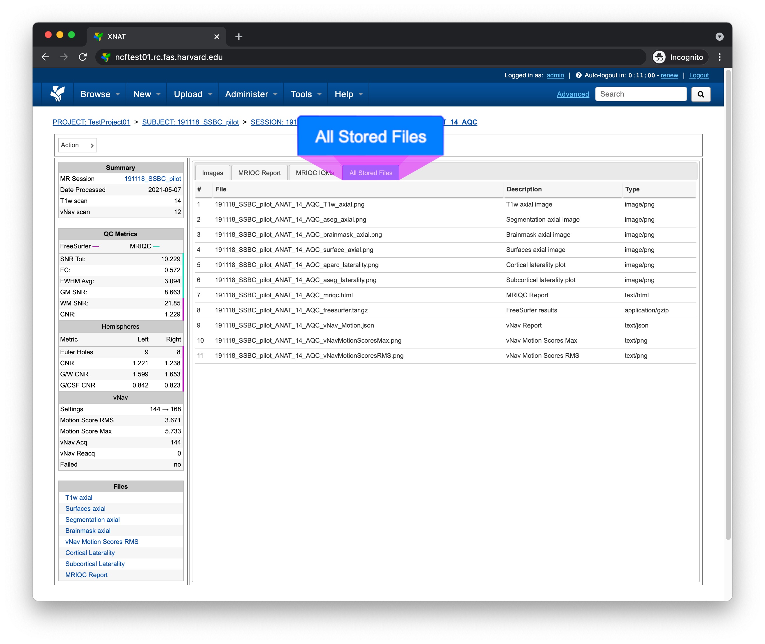 _images/xnat-aqc-files-tab.png