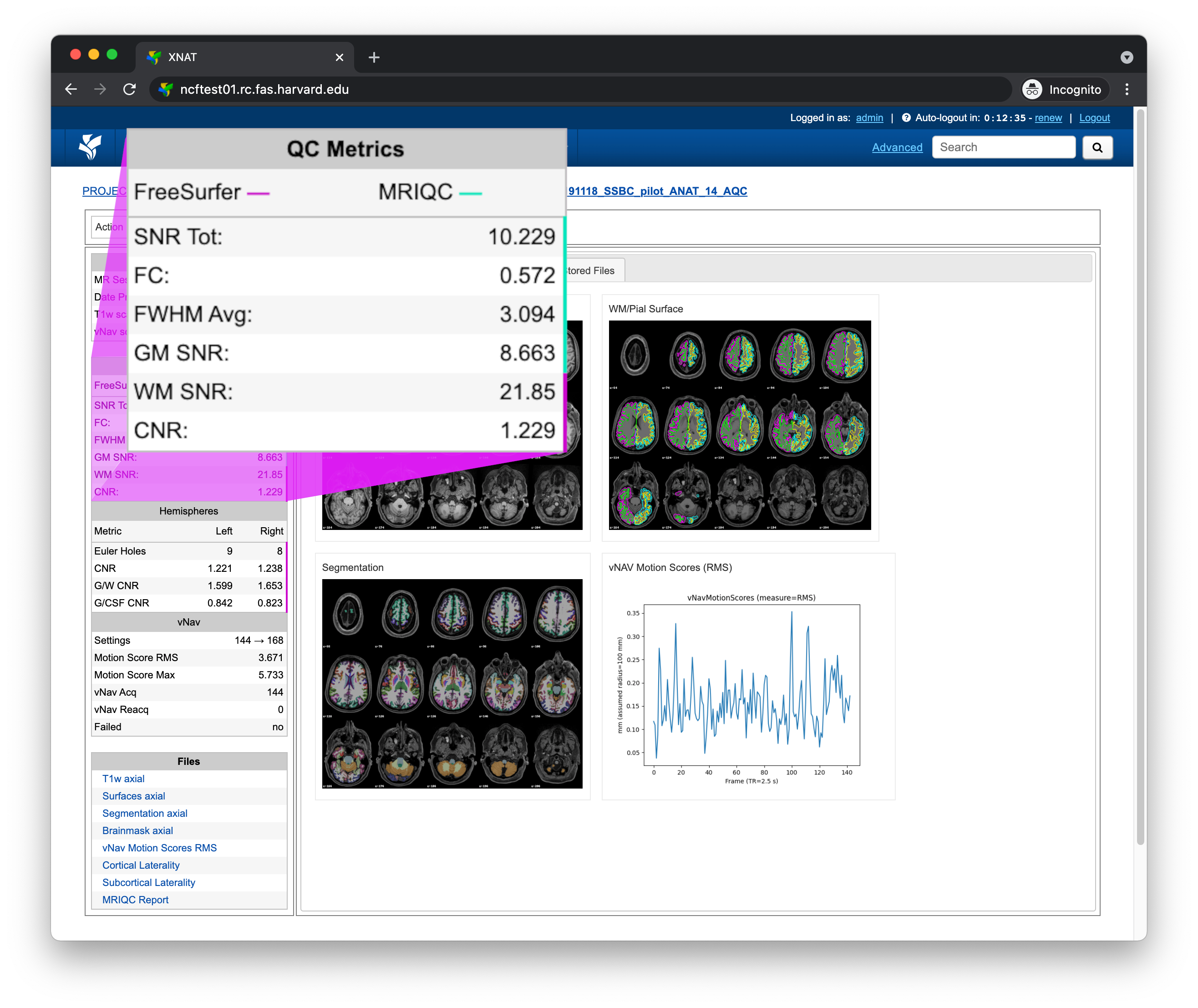 _images/xnat-aqc-left-qcmetrics.png