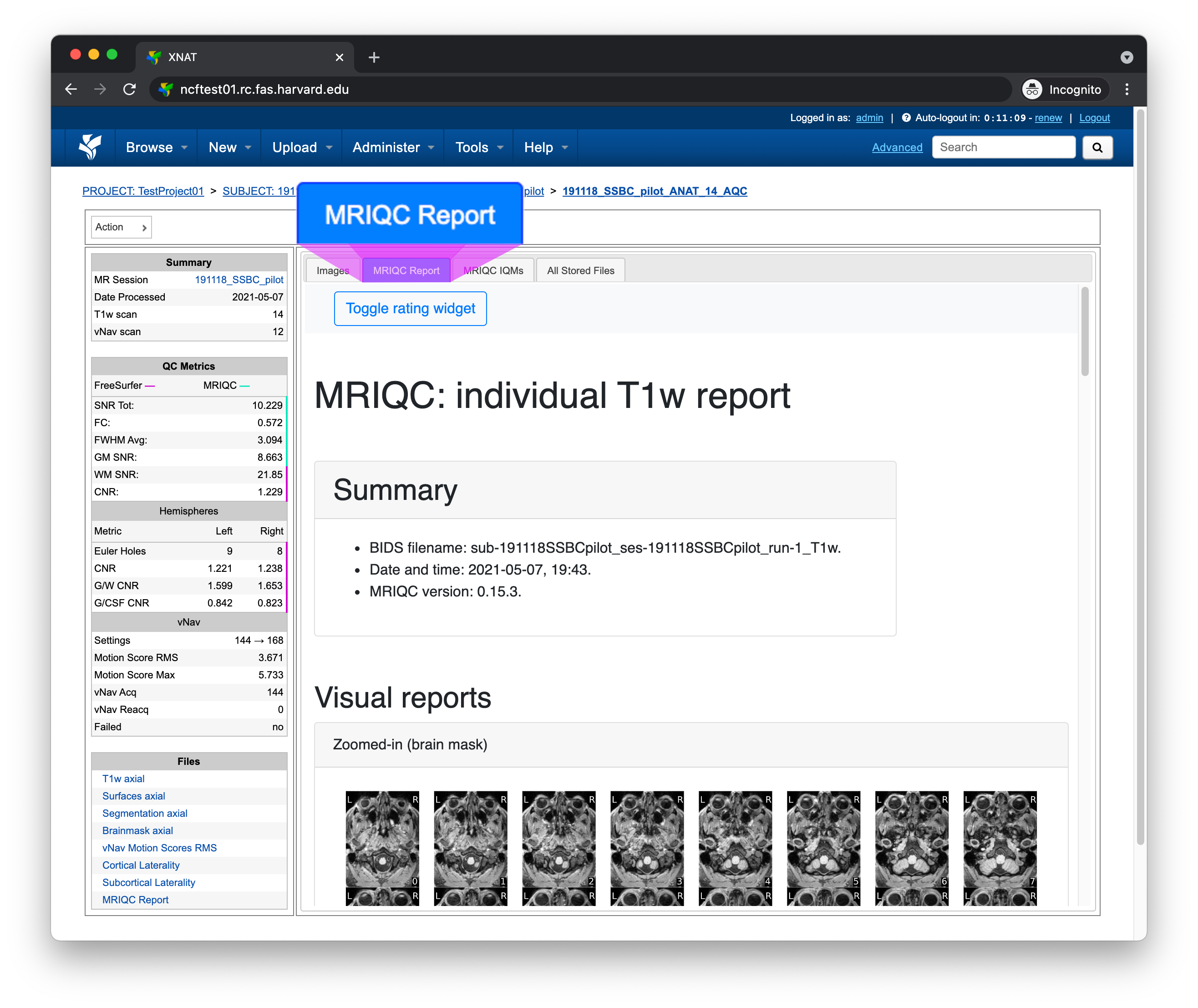 _images/xnat-aqc-mriqc-tab.png